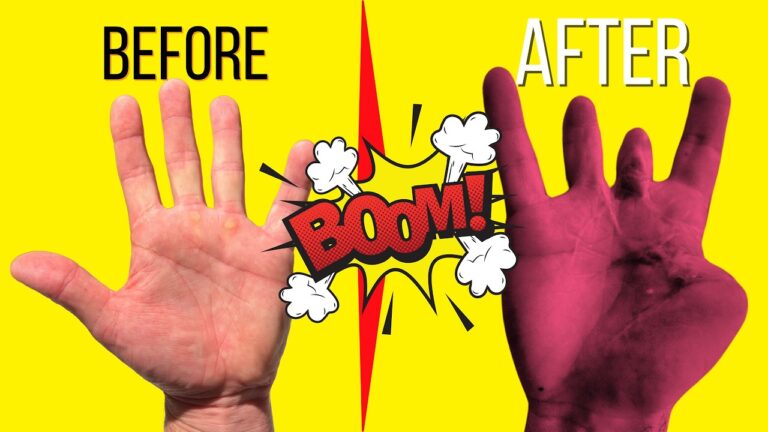 Moments After I BLEW My Fingers OFF